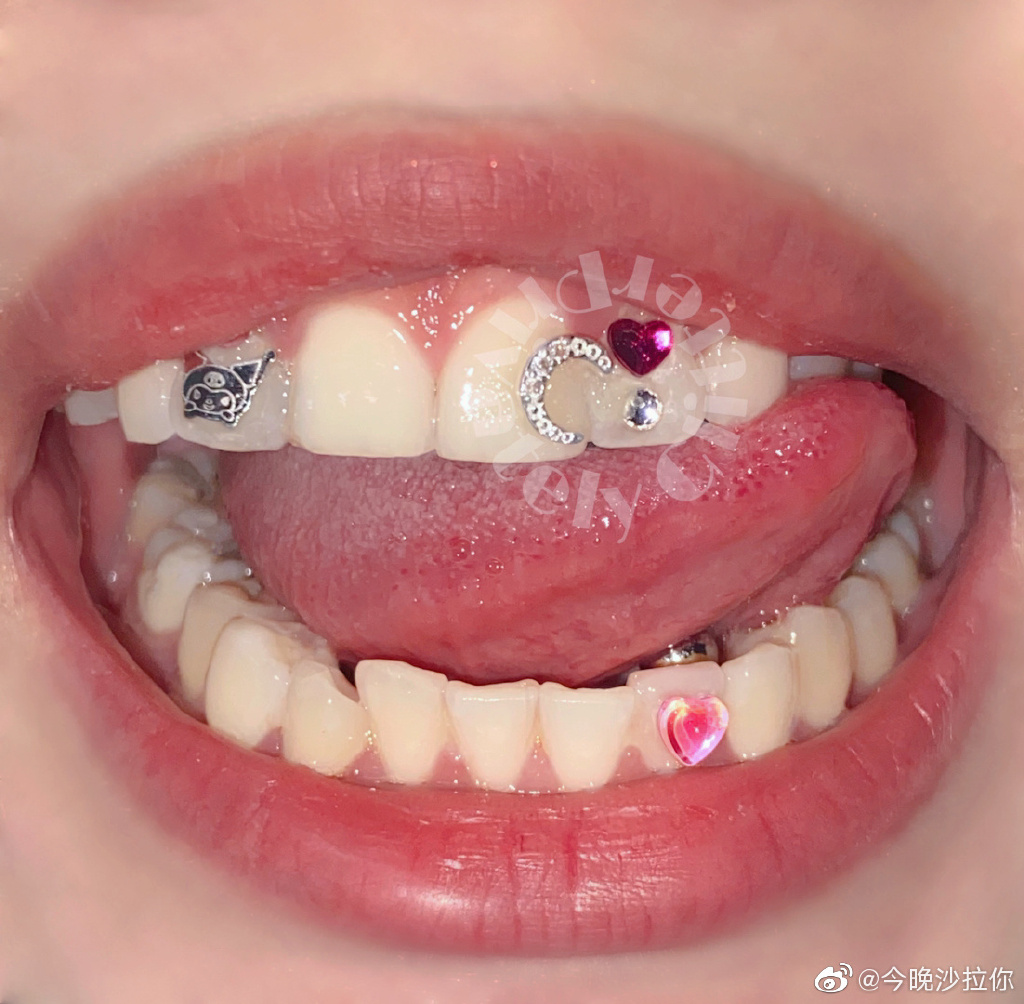镶牙和种牙有什么区别？ - 知乎