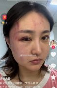 徐大宝老公是谁？她老公贾洪清曾经参加非诚勿扰