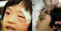 吴镇宇儿子的伤疤谁弄得？是曹格的孩子弄的吗