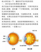 关灯玩手机还是开灯好，关灯玩手机对眼睛的危害案例
