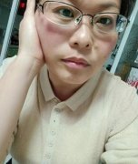 断崖式衰老什么意思，是什么原因，